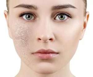 dehydrated skin 11zon 300x247 - بهترین لوازم آرایشی برای پوست خشک